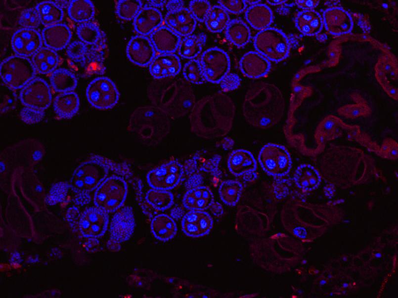 Native bacteria block Wolbachia from being passed to mosquito